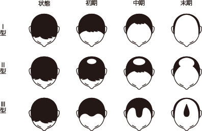 「ヘアサイクル（髪の成長サイクル）」とは？
