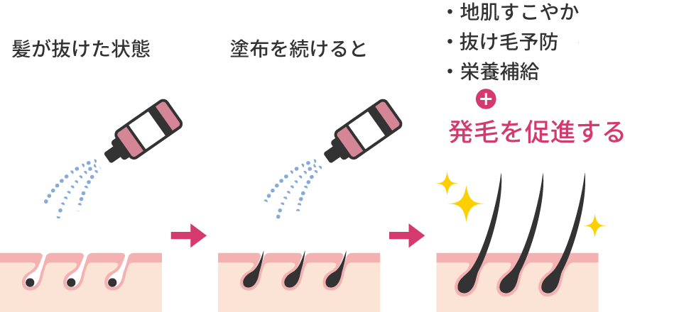 発毛剤の効果図