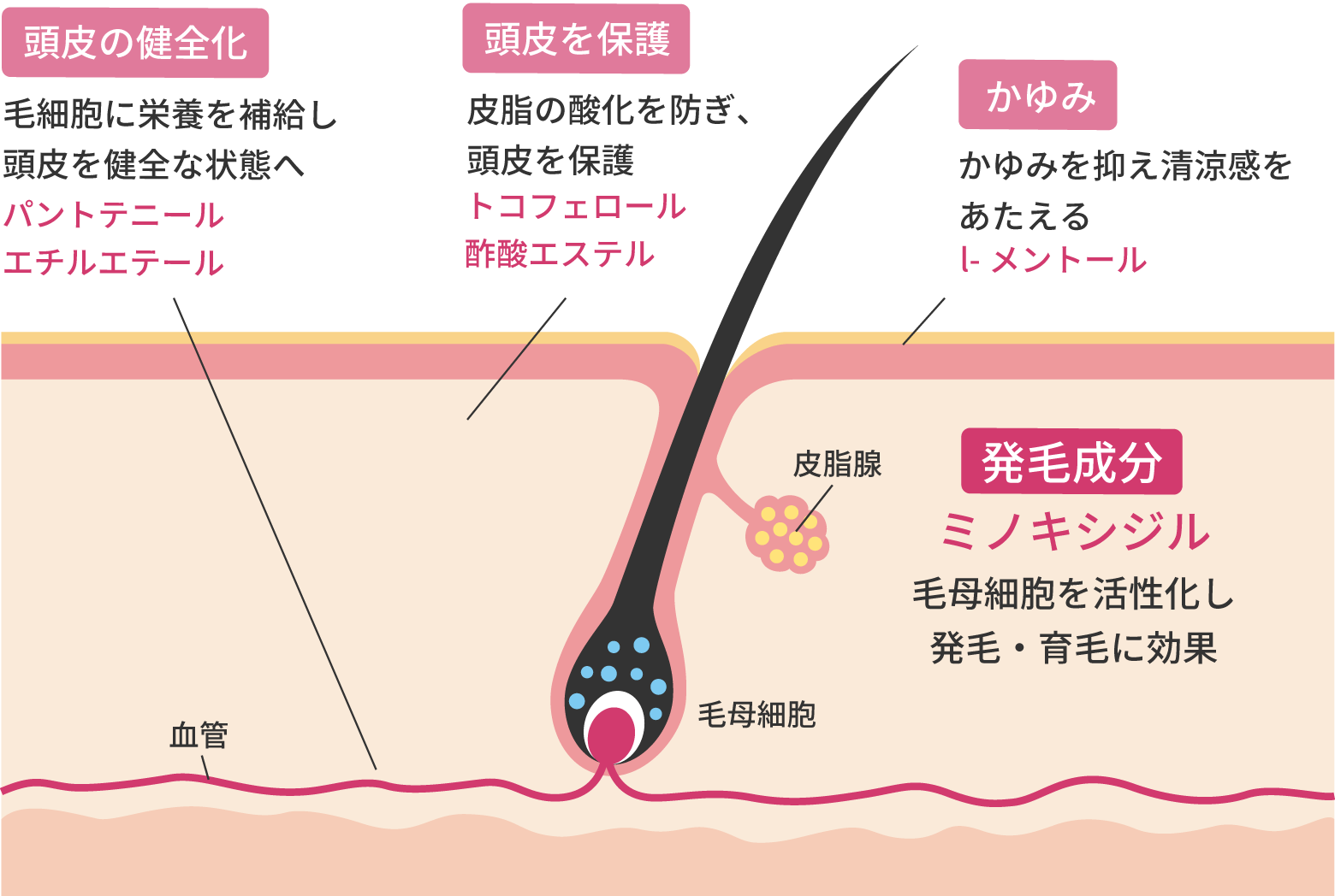 発毛剤 女性薬ミノキシジル配合外用液1％「FCI」の効果・効能