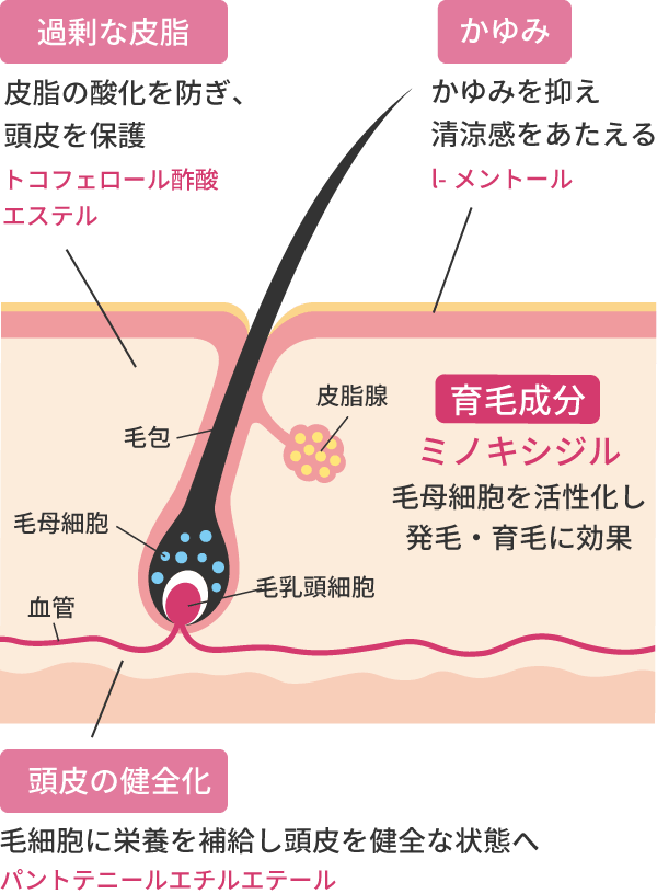 発毛剤 女性薬ミノキシジル配合外用液1％「FCI」の効果・効能