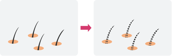 3.発毛しなくなる