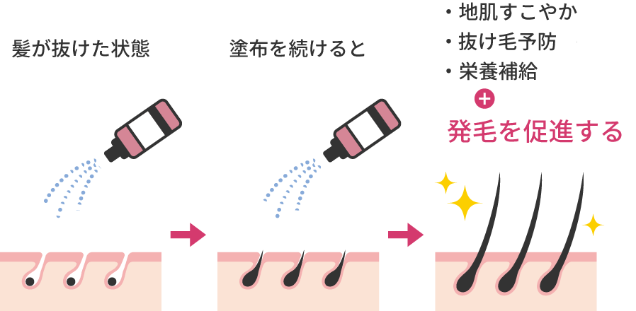 発毛剤の効果図