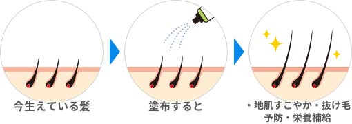 「育毛剤」は“守り”のケア